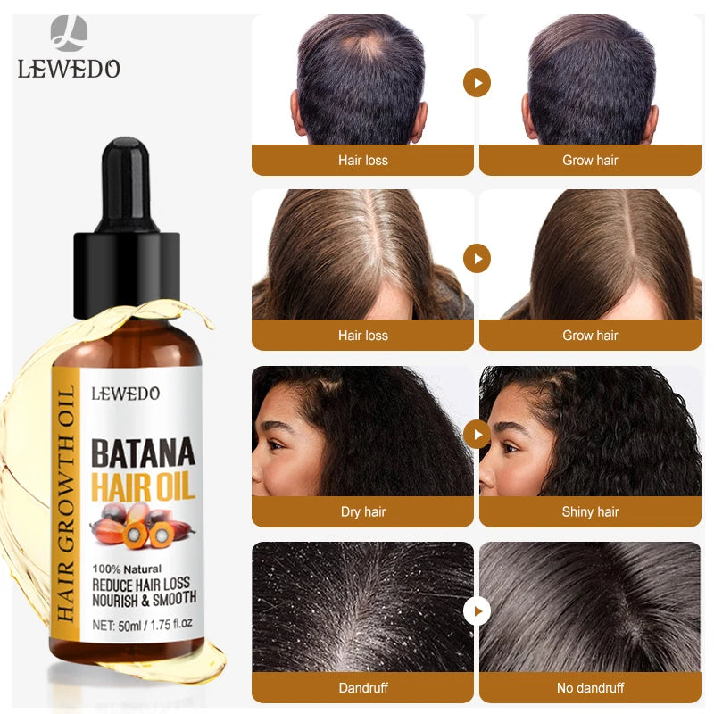 Batana Hair Growth Serum – Faster Growth, Stronger Roots & Zero Hair Fall