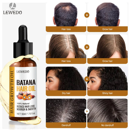 Batana Hair Growth Serum – Faster Growth, Stronger Roots & Zero Hair Fall