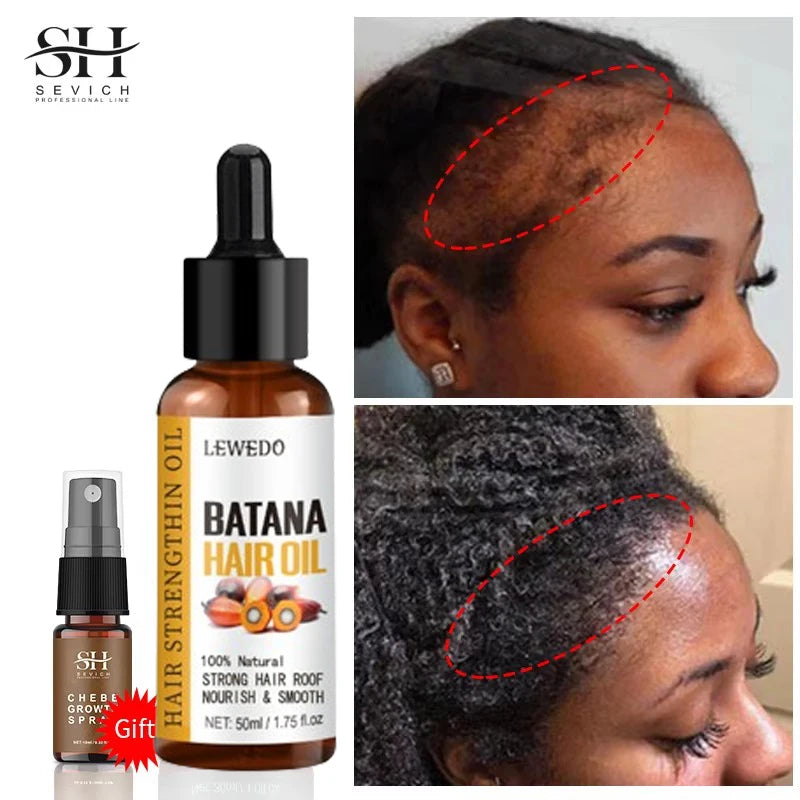 Batana Hair Growth Serum – Faster Growth, Stronger Roots & Zero Hair Fall